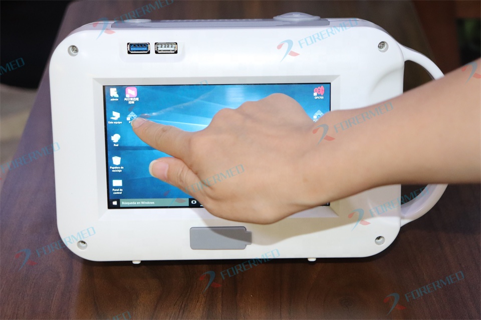 미니 수의학 엑스레이 기기 애완동물 병원 휴대용 디지털 - Vet Tech Accessories 리뷰 및 가격